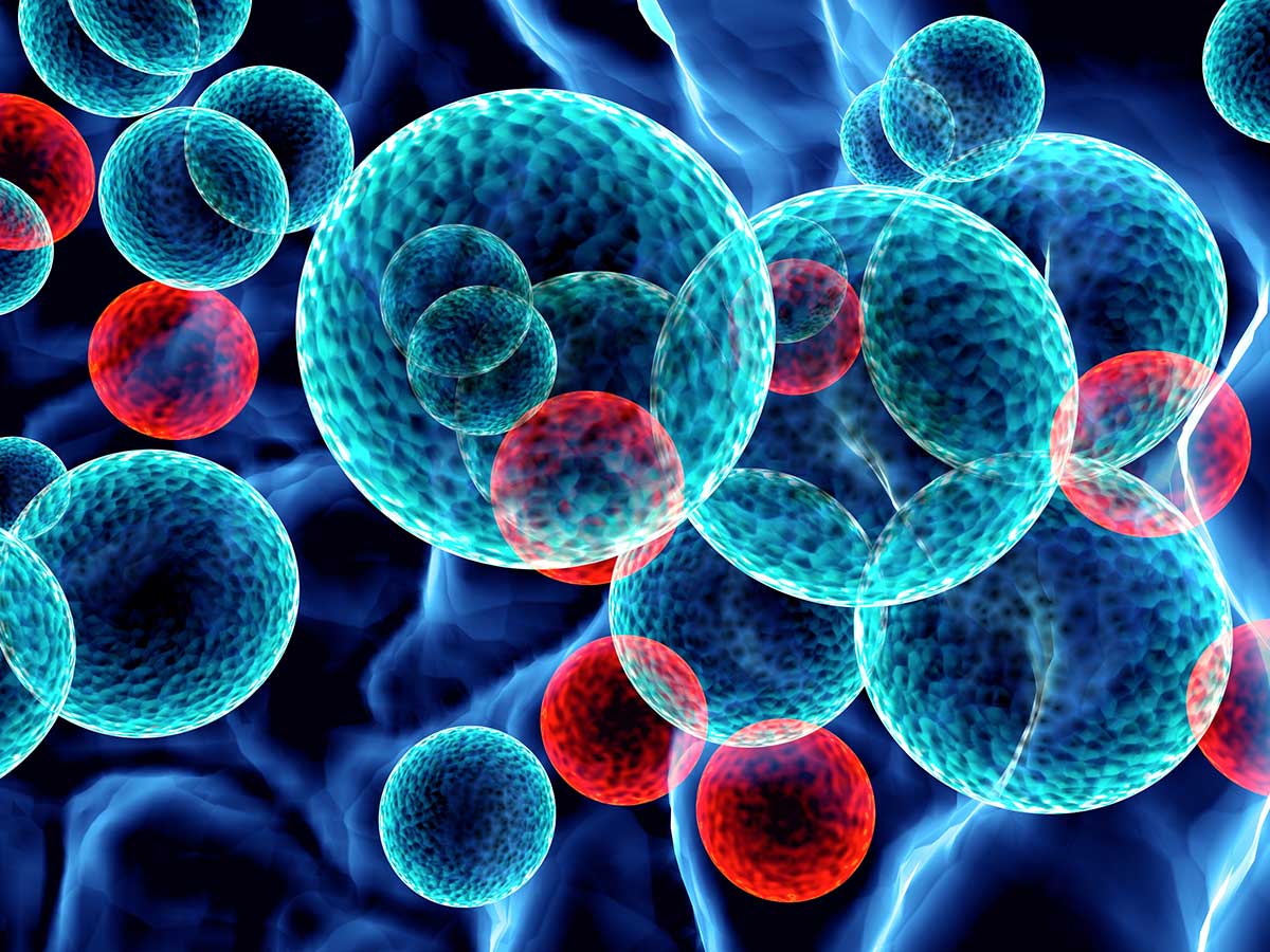 TAMs ROS nanoparticles